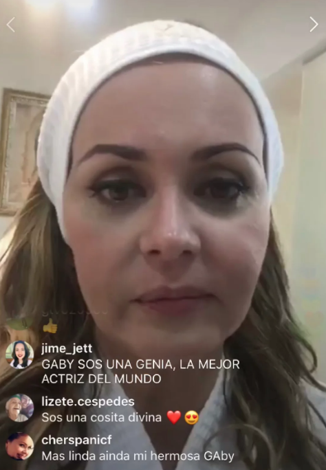 Gaby Spanic estrena rostro, ¡se puso botox!