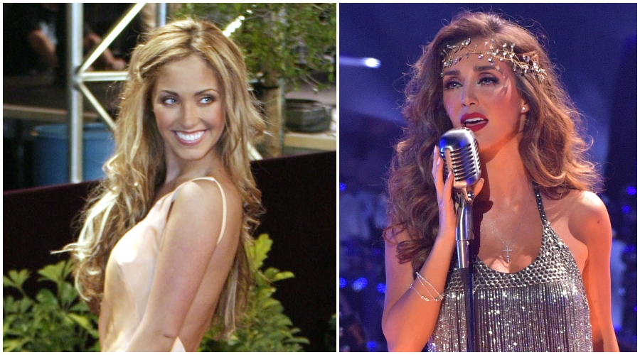 Transformaciones de los famosos: quién tiene más cirugías