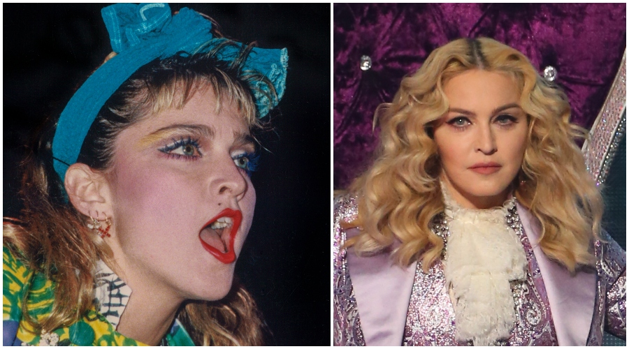 Transformaciones de los famosos: quién tiene más cirugías