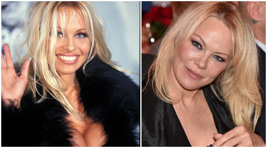 Transformaciones de los famosos: quién tiene más cirugías