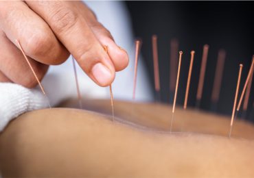 Qué es la acupuntura, para qué es y sus beneficios
