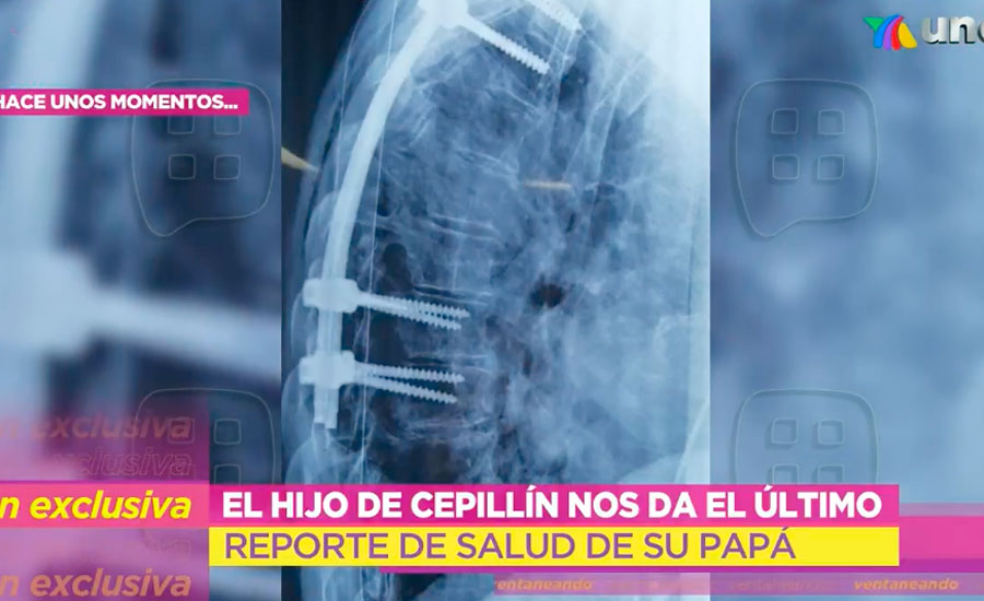 Cepillín
