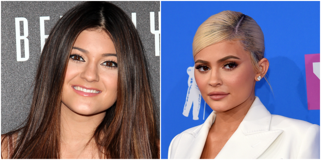 Kylie Jenner jura que no se ha hecho cirugías en la cara