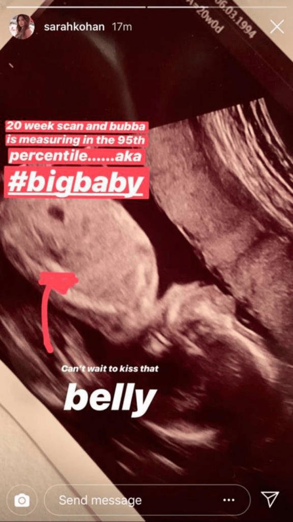 Luego de que Sarah Kohan y el futbolista mexicano Javier Chicharito Hernández anunciaran que se convertirían en padres, la influencer decidió utilizar su cuenta de Instagram para dar los detalles de este lindo proceso que están viviendo. Fue por esta vía que la también modelo publicó su más reciente ultrasonido, en el que se ve al bebé de 20 de semanas. De acuerdo a Sarah Kohan su embarazo marcha de maravilla y se siente contenta con lo mucho que ha crecido su bebé, a quien llamó “big baby”. Minutos más tarde, la influencer compartió una foto ataviada con un ceñido vestido negro con que iría a apoyar a Chicharito Hernández a uno de sus partidos. En la instantánea se ve a la australiana con su mano colocada sobre su vientre, dejando de lado su imagen sexy para dar paso a la maternidad.